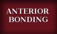 Anterior Bonding